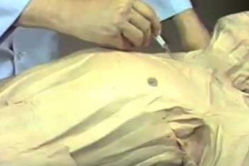 Lecture: Anterior Trunk and Shoulder - Subcutaneous