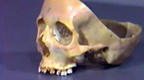 Lecture: Human Skull - Part V
