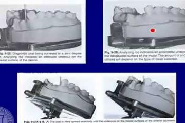 Lecture: Repairing complete and partial dentures