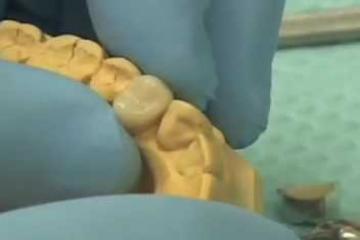 Lecture: Fabricating Provisional Crowns